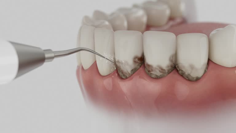 Reliable Dental contractor in Jupiter, FL by Smile Center Dentistry